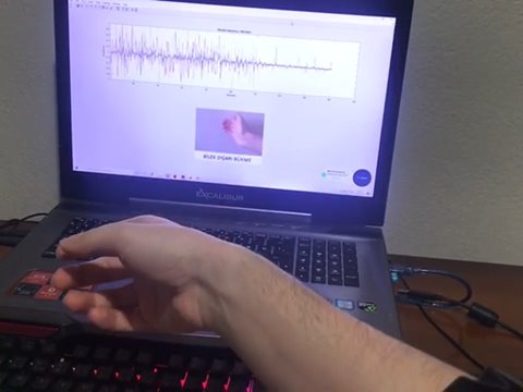 Live sEMG gesture classification running on a laptop during a recording session.