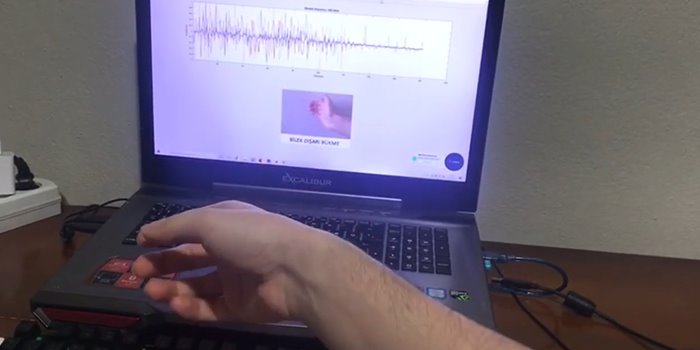 Live classification display showing eight sEMG channel traces beside the predicted hand motion during a recording session.